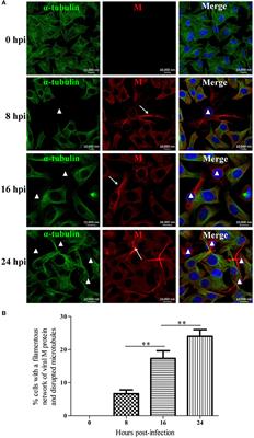 Rabies Virus Infection Induces Microtubule Depolymerization to Facilitate Viral <mark class="highlighted">RNA Synthesis</mark> by Upregulating HDAC6